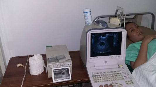 1st-ultrasound